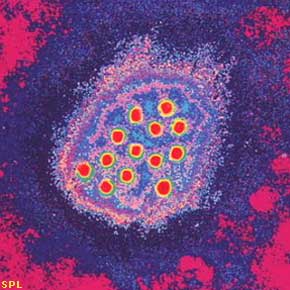 hepatitisa1.jpg